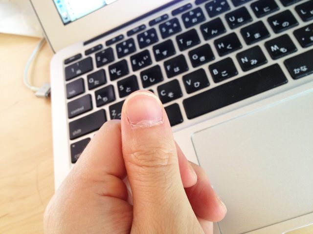 爪が伸びる早さと切る頻度