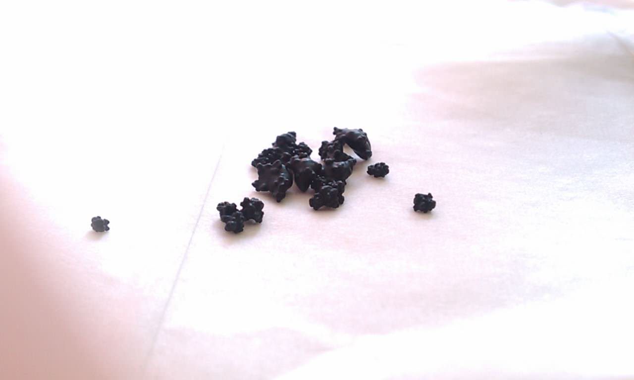 Gallstone